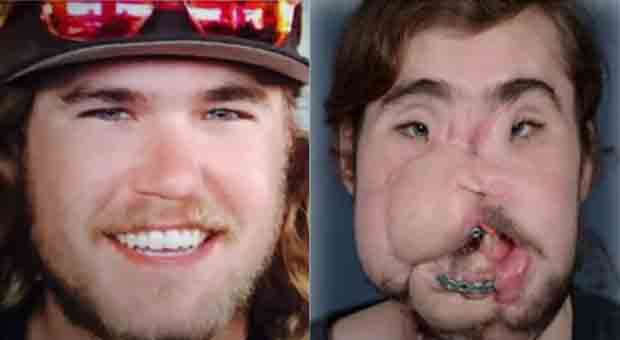 Man receives new face after botched suicide attempt